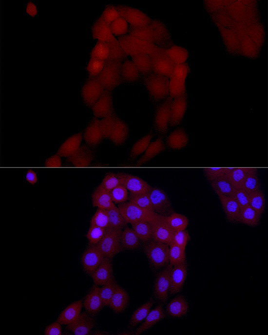 AIM2 Antibody in Immunocytochemistry (ICC/IF)