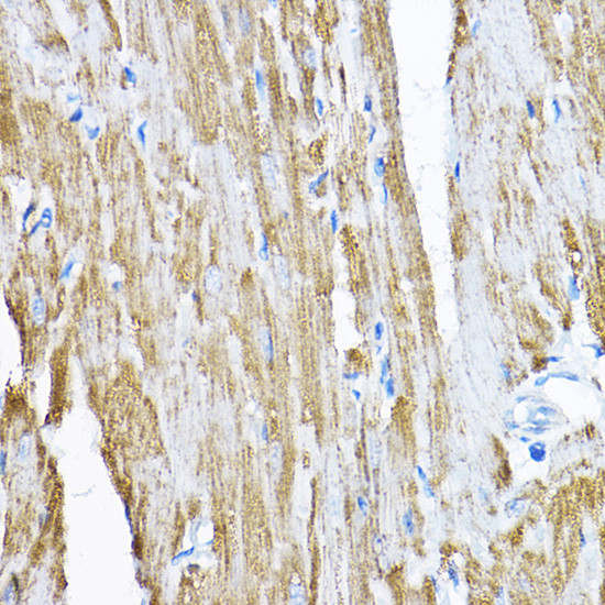 SAMM50 Antibody in Immunohistochemistry (Paraffin) (IHC (P))