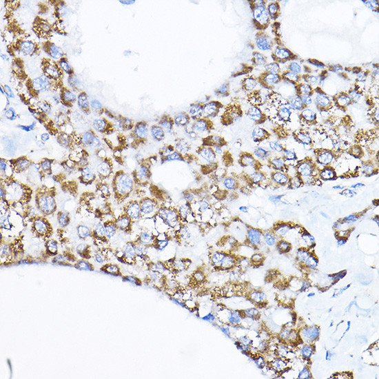 SAMM50 Antibody in Immunohistochemistry (Paraffin) (IHC (P))