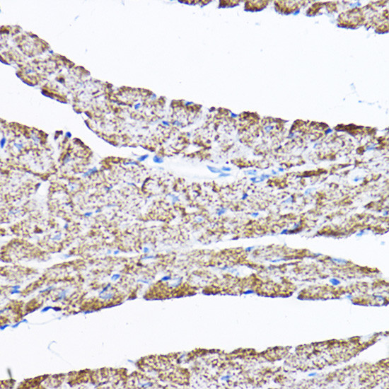 SAMM50 Antibody in Immunohistochemistry (Paraffin) (IHC (P))