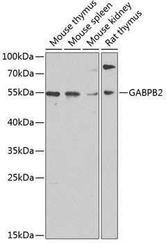 GABPB2 Antibody in Western Blot (WB)