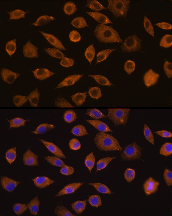 DOCK2 Antibody in Immunocytochemistry (ICC/IF)