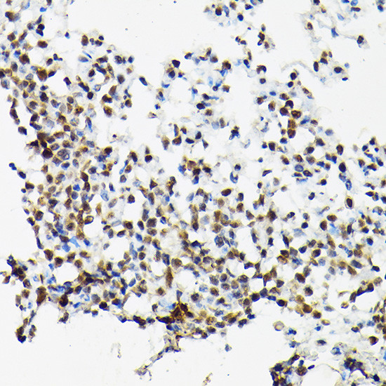 SRSF2 Antibody in Immunohistochemistry (Paraffin) (IHC (P))