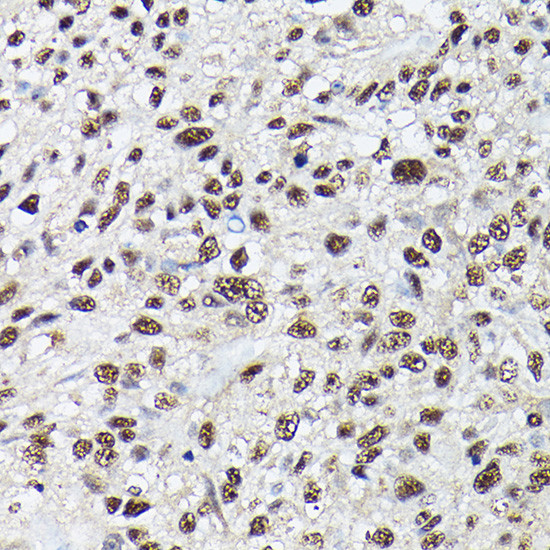 SRSF2 Antibody in Immunohistochemistry (Paraffin) (IHC (P))