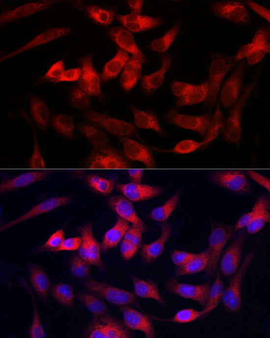 Collagen III Antibody in Immunocytochemistry (ICC/IF)