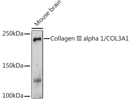 Collagen III Antibody in Western Blot (WB)