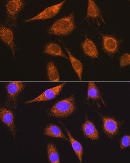 MUT Antibody in Immunocytochemistry (ICC/IF)