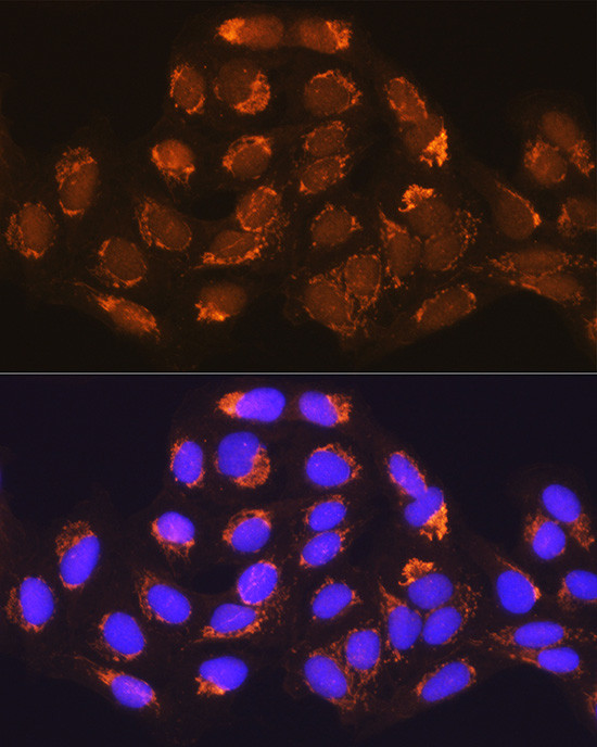 MUT Antibody in Immunocytochemistry (ICC/IF)