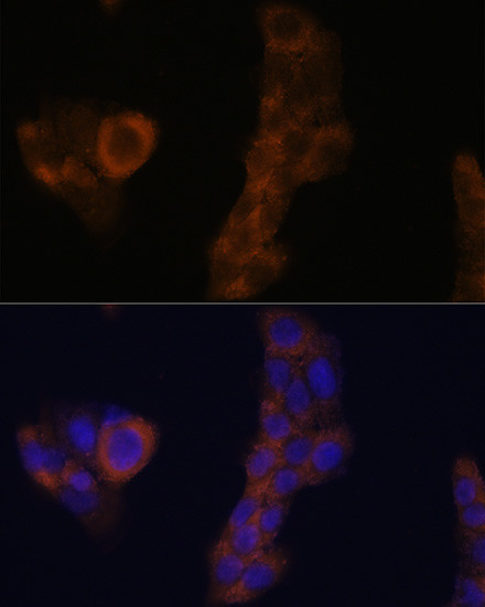 RPL23A Antibody in Immunocytochemistry (ICC/IF)