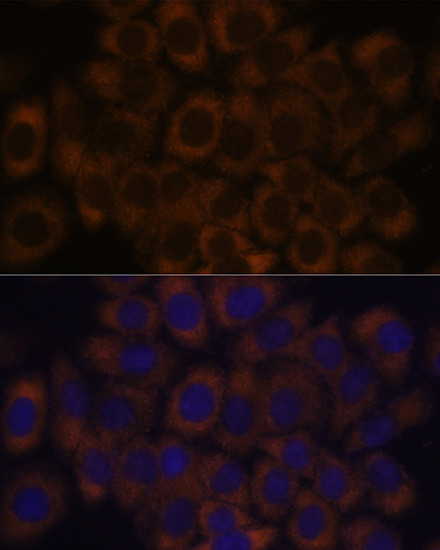 RPL23A Antibody in Immunocytochemistry (ICC/IF)