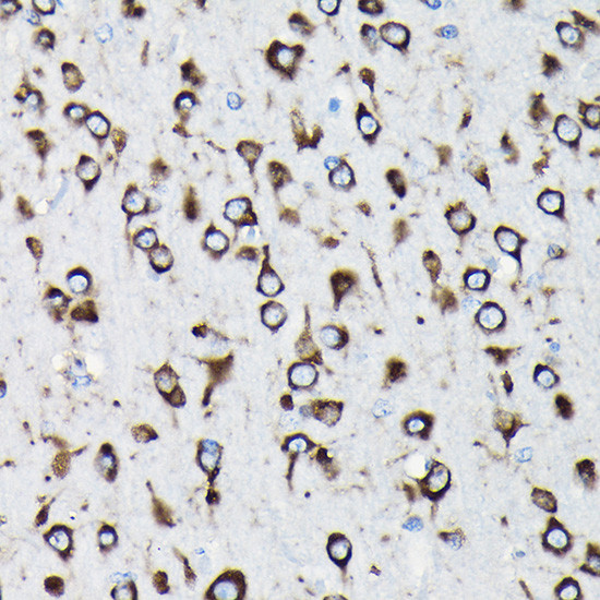 RPL23A Antibody in Immunohistochemistry (Paraffin) (IHC (P))