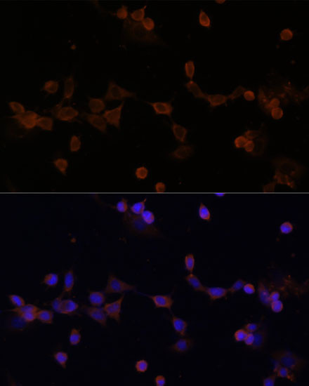 UBE2L3 Antibody in Immunocytochemistry (ICC/IF)