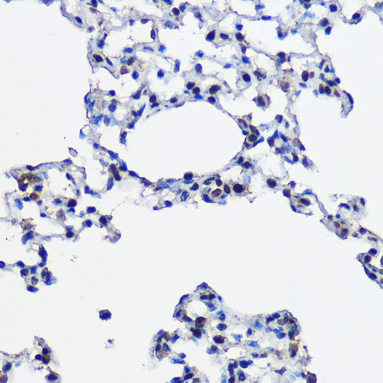 UBE2L3 Antibody in Immunohistochemistry (Paraffin) (IHC (P))