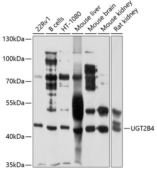 UGT2B4 Antibody in Western Blot (WB)