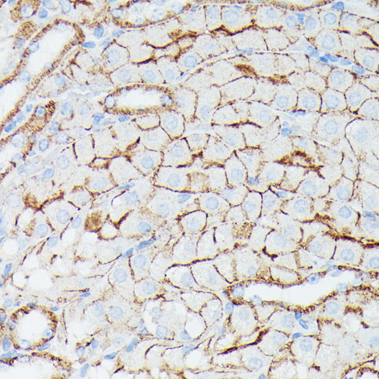 IFITM1 Antibody in Immunohistochemistry (Paraffin) (IHC (P))