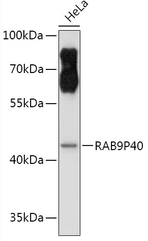 p40 Antibody in Western Blot (WB)