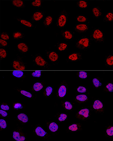 BCAS2 Antibody in Immunocytochemistry (ICC/IF)