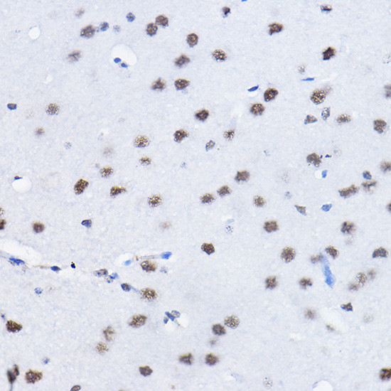 BCAS2 Antibody in Immunohistochemistry (Paraffin) (IHC (P))