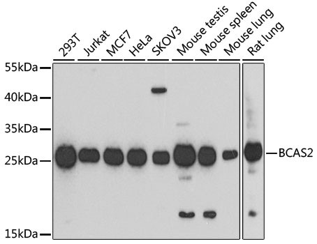 BCAS2 Antibody in Western Blot (WB)