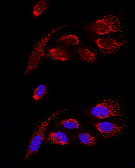 ATP5H Antibody in Immunocytochemistry (ICC/IF)