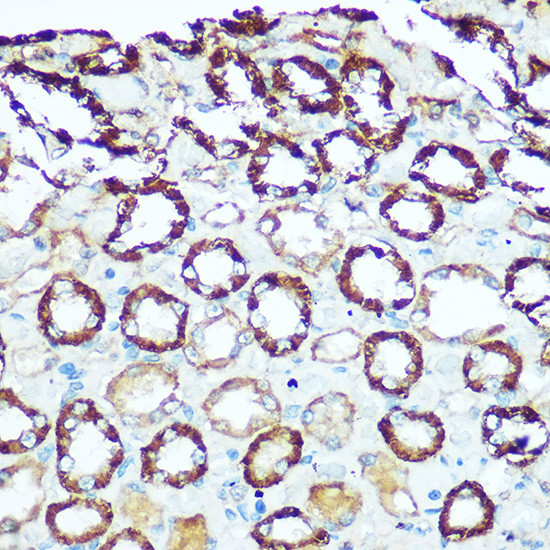 ATP5H Antibody in Immunohistochemistry (Paraffin) (IHC (P))