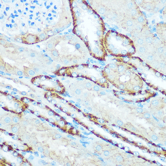 ATP5H Antibody in Immunohistochemistry (Paraffin) (IHC (P))