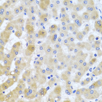 PCID1 Antibody in Immunohistochemistry (Paraffin) (IHC (P))