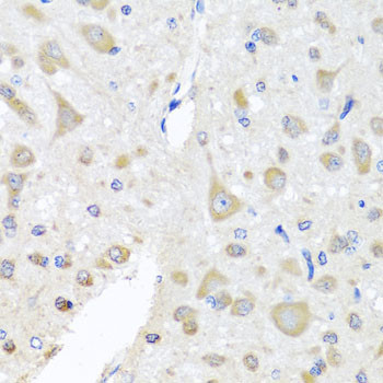 PCID1 Antibody in Immunohistochemistry (Paraffin) (IHC (P))