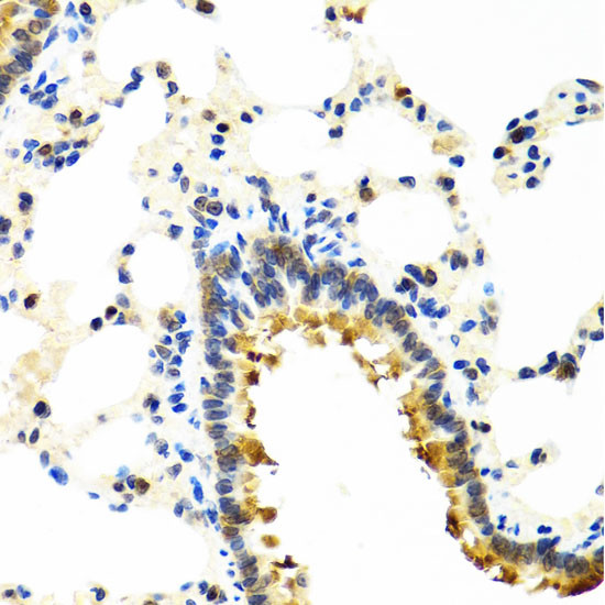 CRTAP Antibody in Immunohistochemistry (Paraffin) (IHC (P))