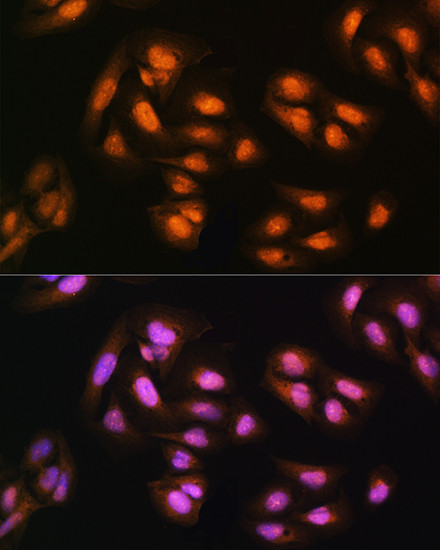 ADRM1 Antibody in Immunocytochemistry (ICC/IF)