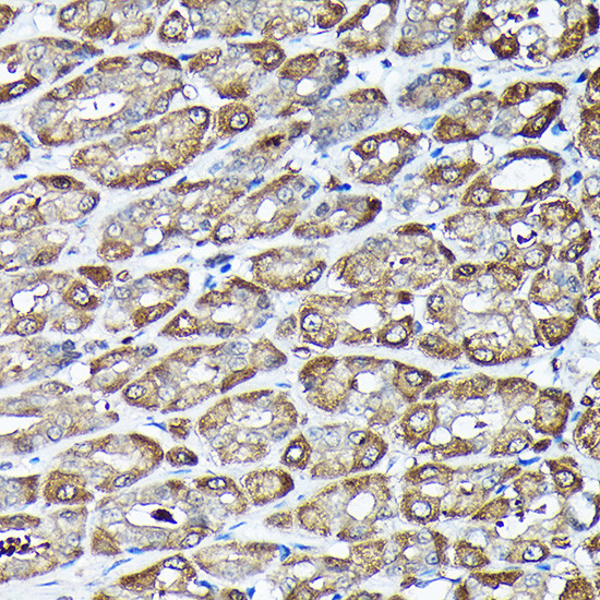 ADRM1 Antibody in Immunohistochemistry (Paraffin) (IHC (P))