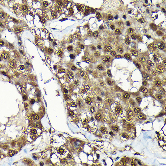 ADRM1 Antibody in Immunohistochemistry (Paraffin) (IHC (P))