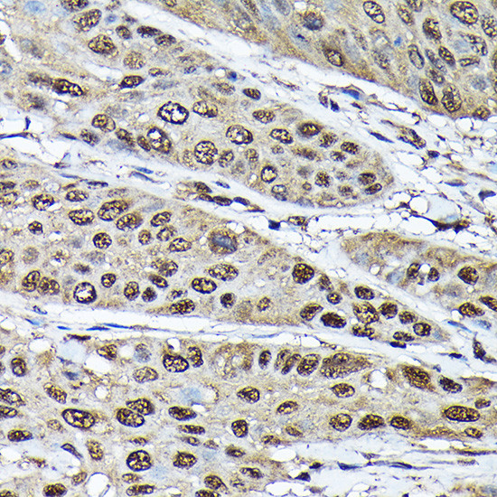 ADRM1 Antibody in Immunohistochemistry (Paraffin) (IHC (P))