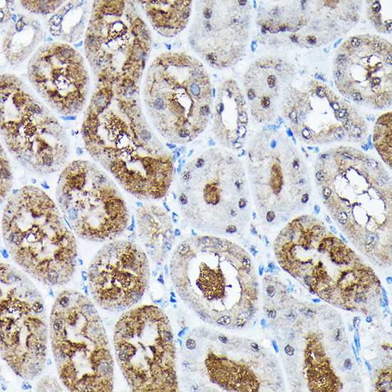 ADRM1 Antibody in Immunohistochemistry (Paraffin) (IHC (P))