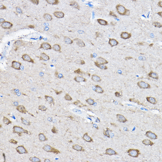 PTPN23 Antibody in Immunohistochemistry (Paraffin) (IHC (P))