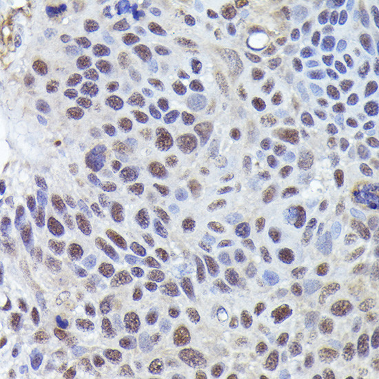 CRCP Antibody in Immunohistochemistry (Paraffin) (IHC (P))