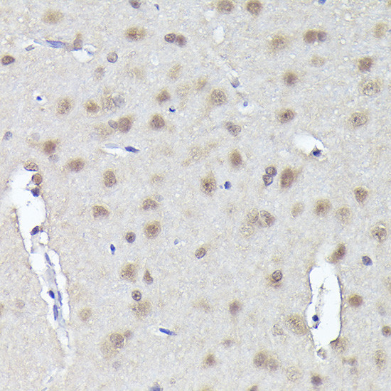 CRCP Antibody in Immunohistochemistry (Paraffin) (IHC (P))