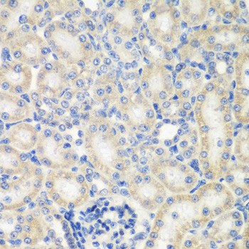 NAT13 Antibody in Immunohistochemistry (Paraffin) (IHC (P))