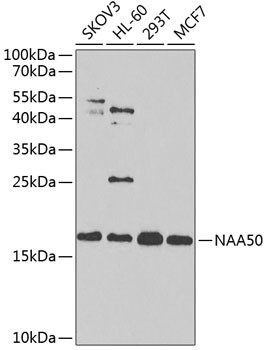 NAT13 Antibody in Western Blot (WB)