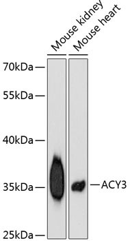 ACY3 Antibody in Western Blot (WB)