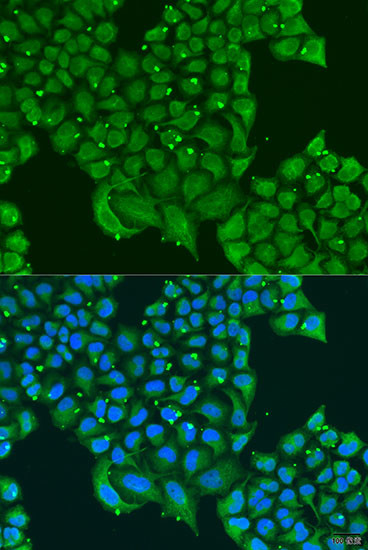 ATPIF1 Antibody in Immunocytochemistry (ICC/IF)