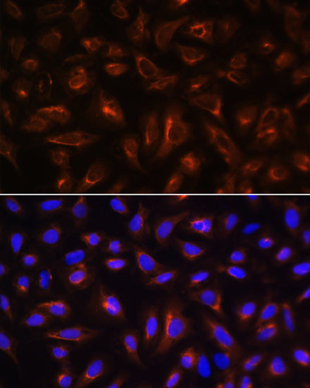 ARL13B Antibody in Immunocytochemistry (ICC/IF)