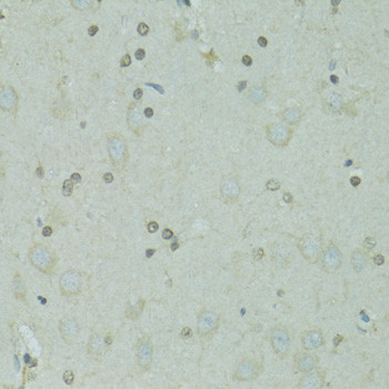 GTF2H2C Antibody in Immunohistochemistry (Paraffin) (IHC (P))