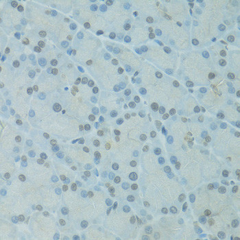 GTF2H2C Antibody in Immunohistochemistry (Paraffin) (IHC (P))