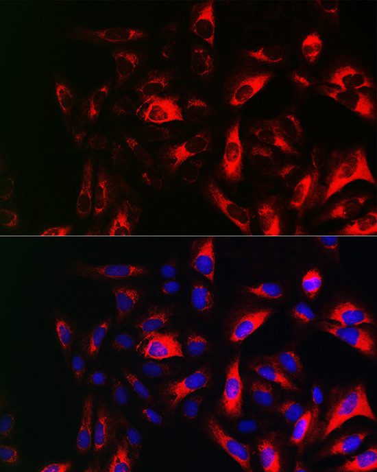 RRM2 Antibody in Immunocytochemistry (ICC/IF)