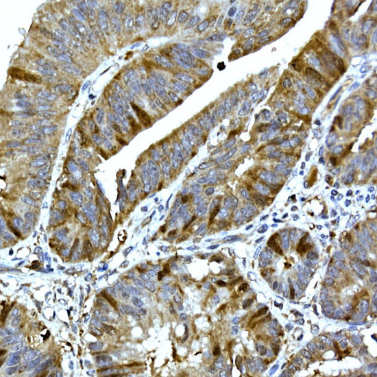 RRM2 Antibody in Immunohistochemistry (Paraffin) (IHC (P))