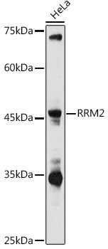 RRM2 Antibody in Western Blot (WB)