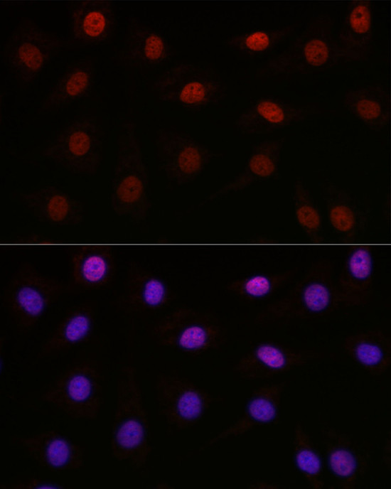 SETD8 Antibody in Immunocytochemistry (ICC/IF)