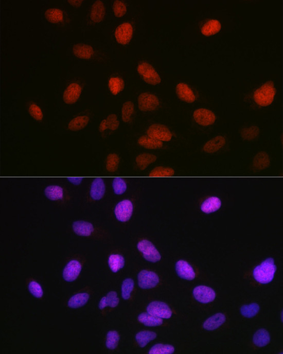 SETD8 Antibody in Immunocytochemistry (ICC/IF)