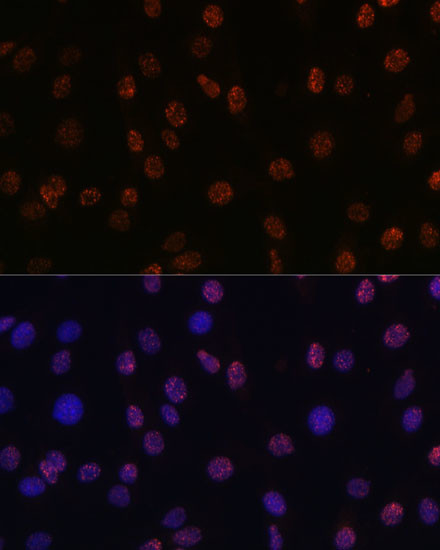 H3K14me2 Antibody in Immunocytochemistry (ICC/IF)